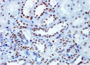 PP-H7147-00 IHC Data