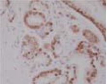 PP-H7507-00 IHC Data