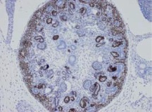 PP-K9814-00 IHC Data